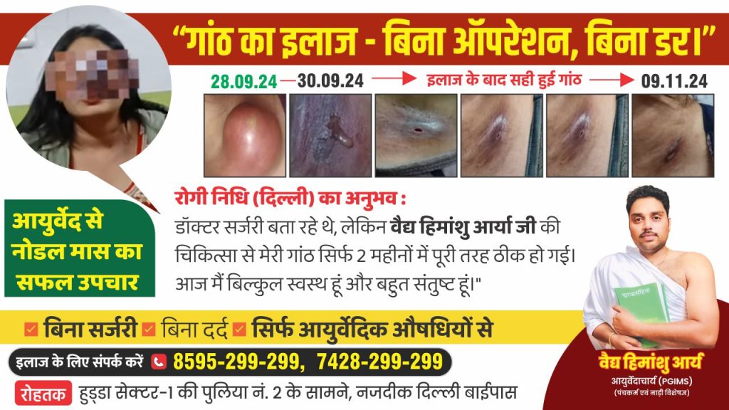 Ayurvedic treatment for Gathiya