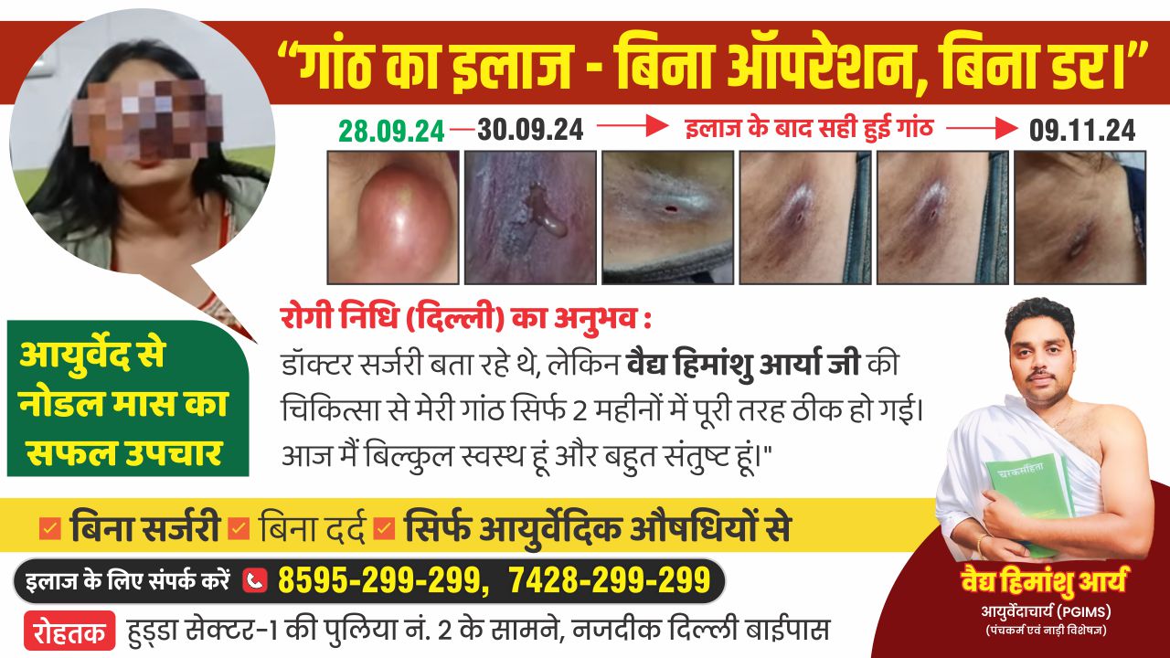 Ayurvedic treatment for Gathiya