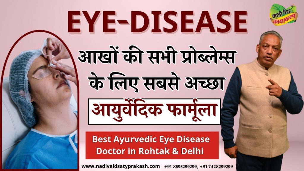 Best Ayurvedic Doctor Hospital for Eye Treatment