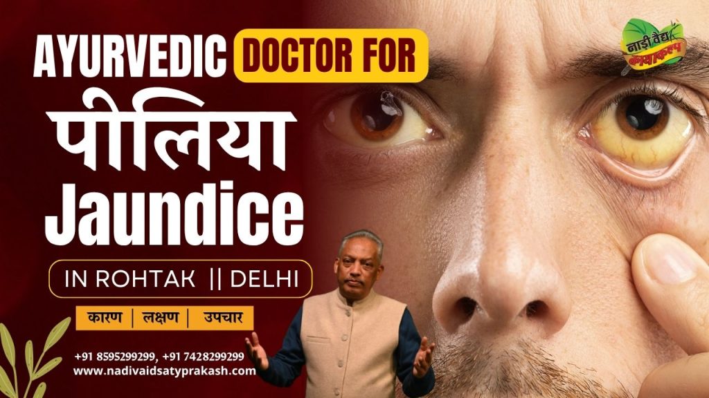 Best Ayurvedic Doctor for Jaundice Disease in Rohtak & Delhi