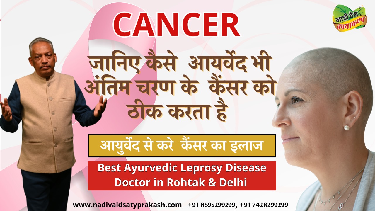 Ayurvedic hospital in Delhi for cancer
