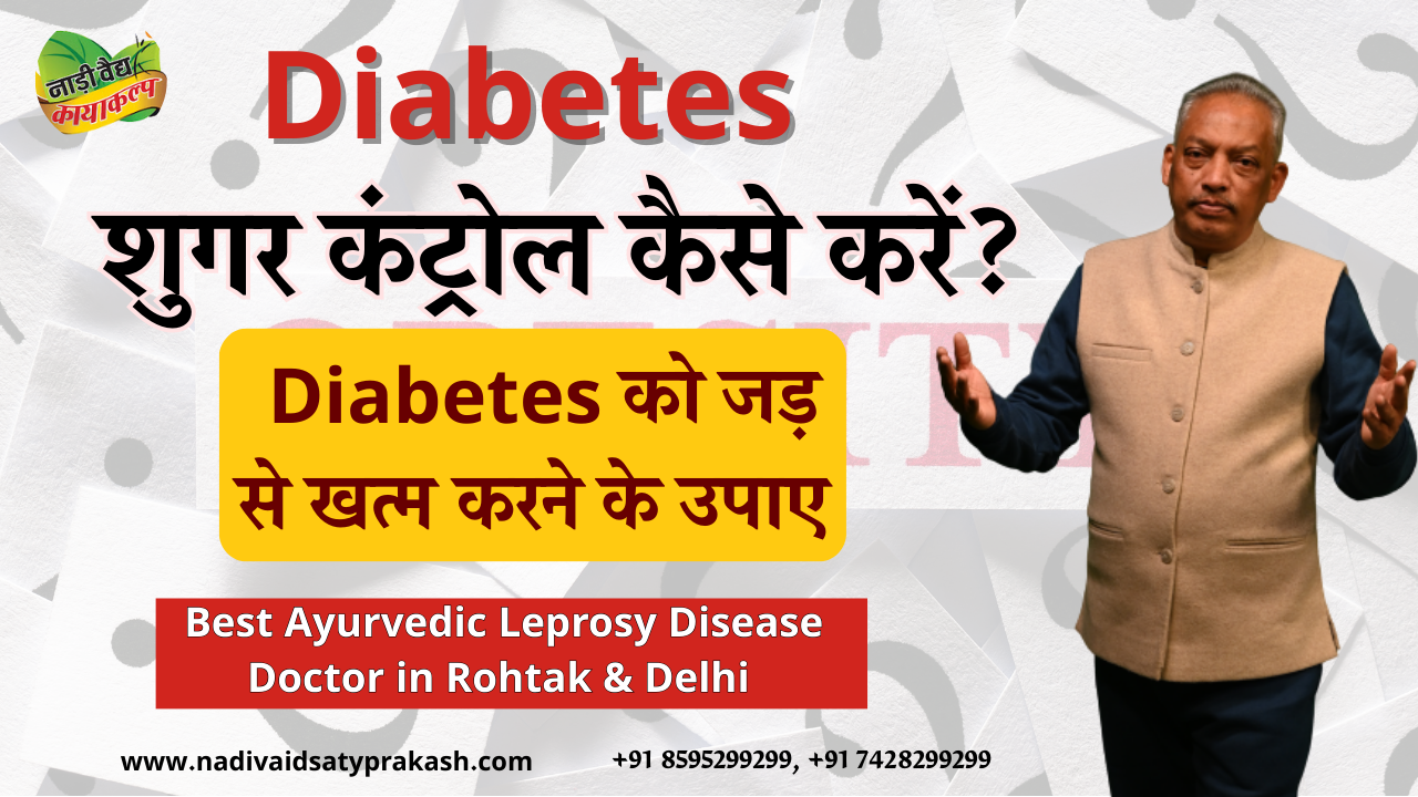 Best Ayurvedic Doctor Treatment for Diabtes