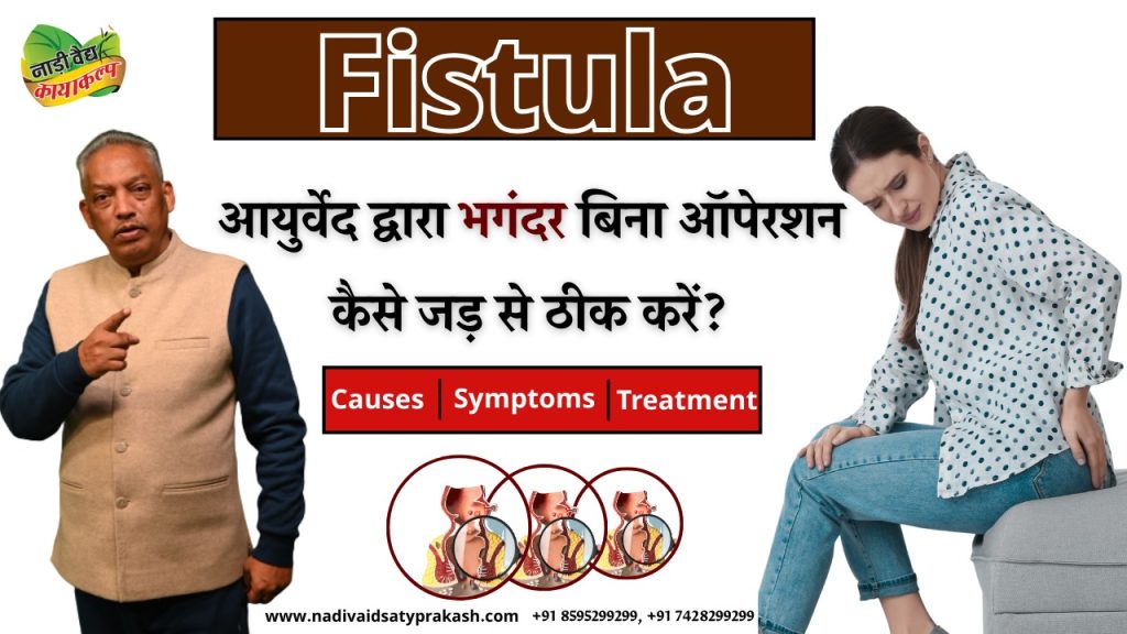 Best Ayurvedic Fistula Treatment in Rohtak