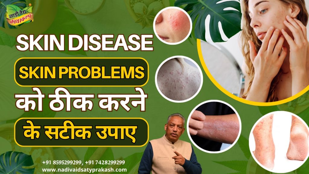 Best Ayurvedic Treatment for Skin Disease in Rohtak and Delhi