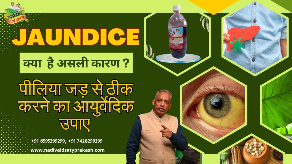 Best Ayurvedic Treatment Hospital for Jaundice in Rohtak