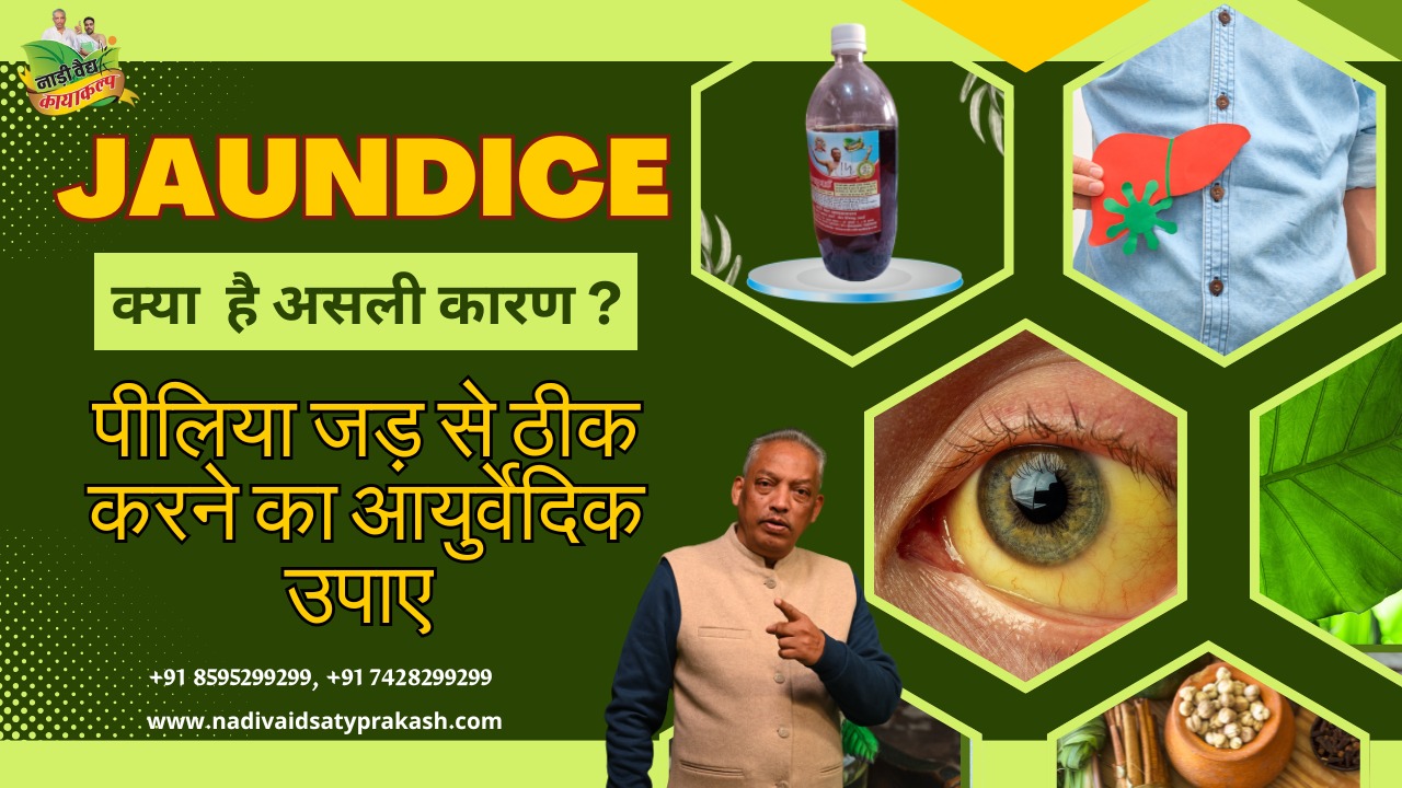 Best Ayurvedic Treatment Hospital for Jaundice in Rohtak