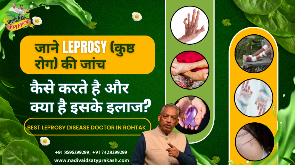 Best Ayurvedic Doctor Treatment Hospital for Leprosy in Rohtak